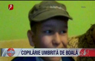 Copilarie umbrita de boala