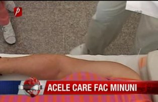 Acele care fac minuni