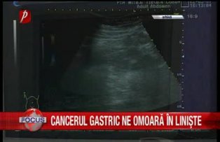 Cancerul gastric ne omoara in liniste