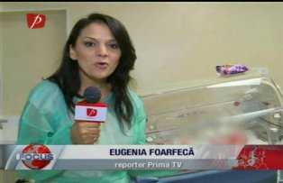 Siamezele gata de externare