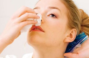 Tratamente naturiste pentru sangerari nazale