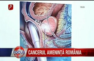 Cancerul ameninţă România
