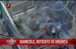 Siamezele botezate de urgenta