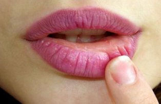 Ce spune gura despre sanatatea inimii tale