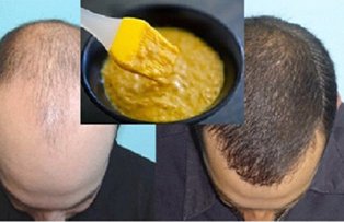 Tratament eficient pentru cresterea si regenerarea parului. Se prepara cu ingrediente pe care le ai in casa