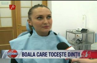 Boala care toceste dintii