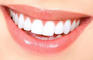 Mituri despre albirea dentara: ce este adevarat si ce este fals