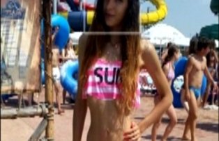 Boala de gura lumii