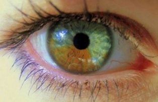 Ce spun ochii despre sanatatea ta