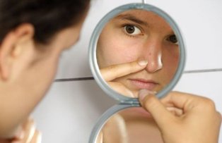 Suferi de acnee? Iata care ar putea fi cauza