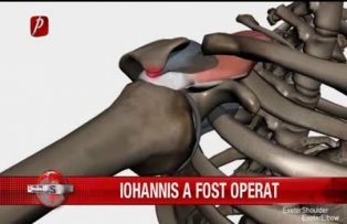 Iohannis a fost operat