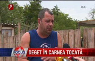 Deget în carnea tocată