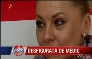 Desfigurata de medic