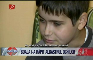 Boala i-a rapit albastrul ochilor