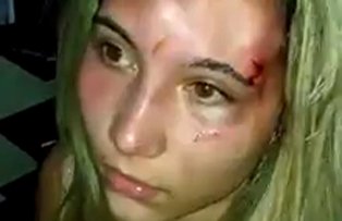 VIDEO / Violenta iesita din comun! O tanara a fost batuta, arsa cu tigara si umilita in utimul hal. Vezi motivul