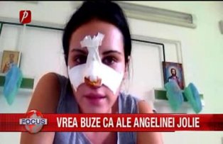 Vrea buze ca ale Angelinei
