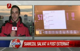 Siamezul salvat a fost externat