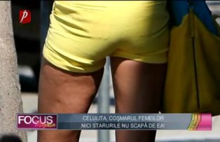 Celulita, dusmanul femeilor. Nici vedetele nu scapa d ea