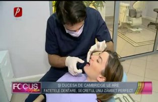 Şi Ducesa de Cambridge le are. Faţetele dentare, secretul unui zâmbet perfect
