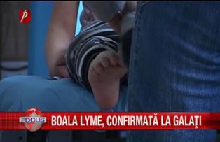 Boala Lyme, confirmata la Galati
