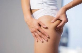 Cremele impotriva celulitei: eficiente sau nu?