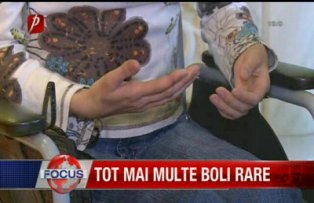 Tot mai multe boli rare