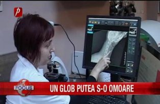 Un glob putea s-o omoare