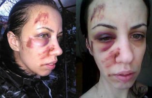 O tanara cere disperata ajutor pe Facebook. "Fostul iubit ma bate si Politia nu face nimic. O sa ma omoare!"