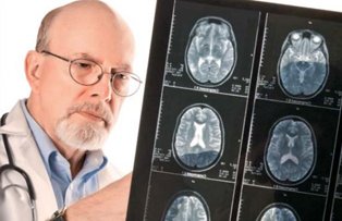 Testul prin care poate fi depistat Alzheimerul