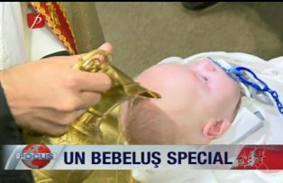 Un bebeluş special