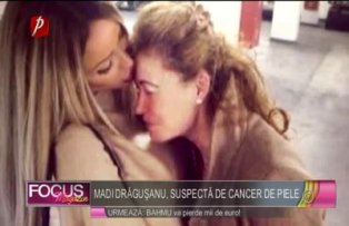 Madi Drăguşanu, suspectă de cancer de piele
